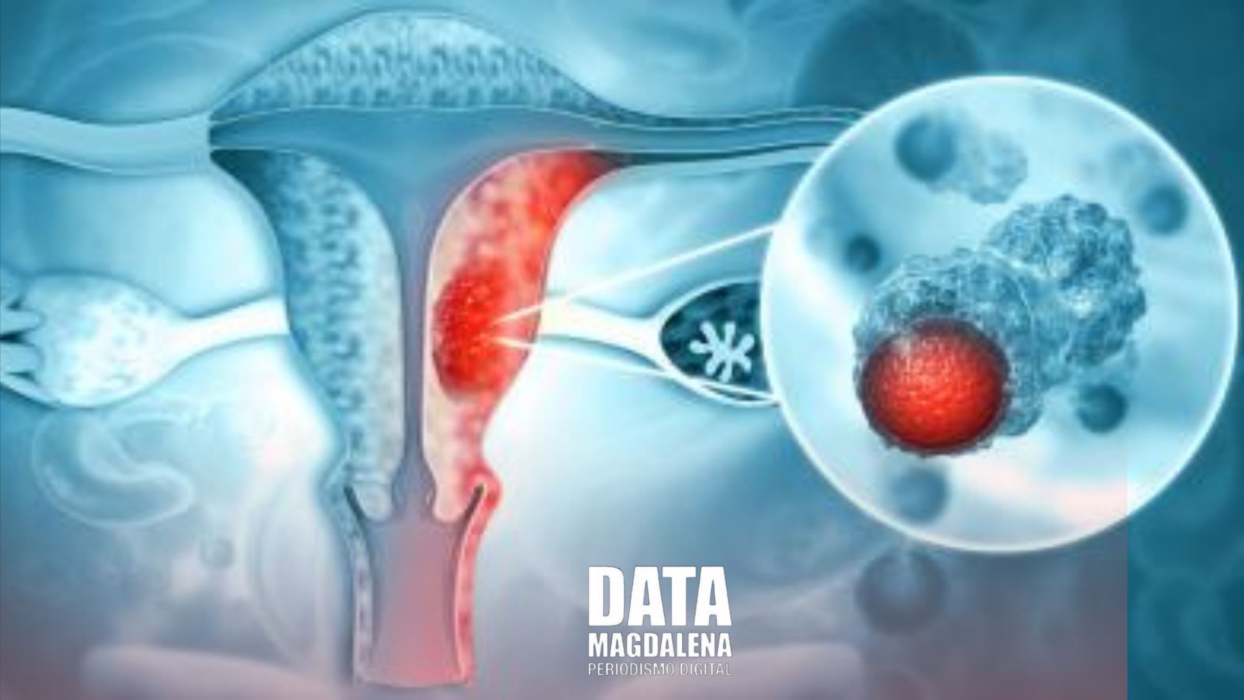 Prevenci&oacute;n Activa: Jornadas de PAP para Combatir el C&aacute;ncer de Cuello Uterino