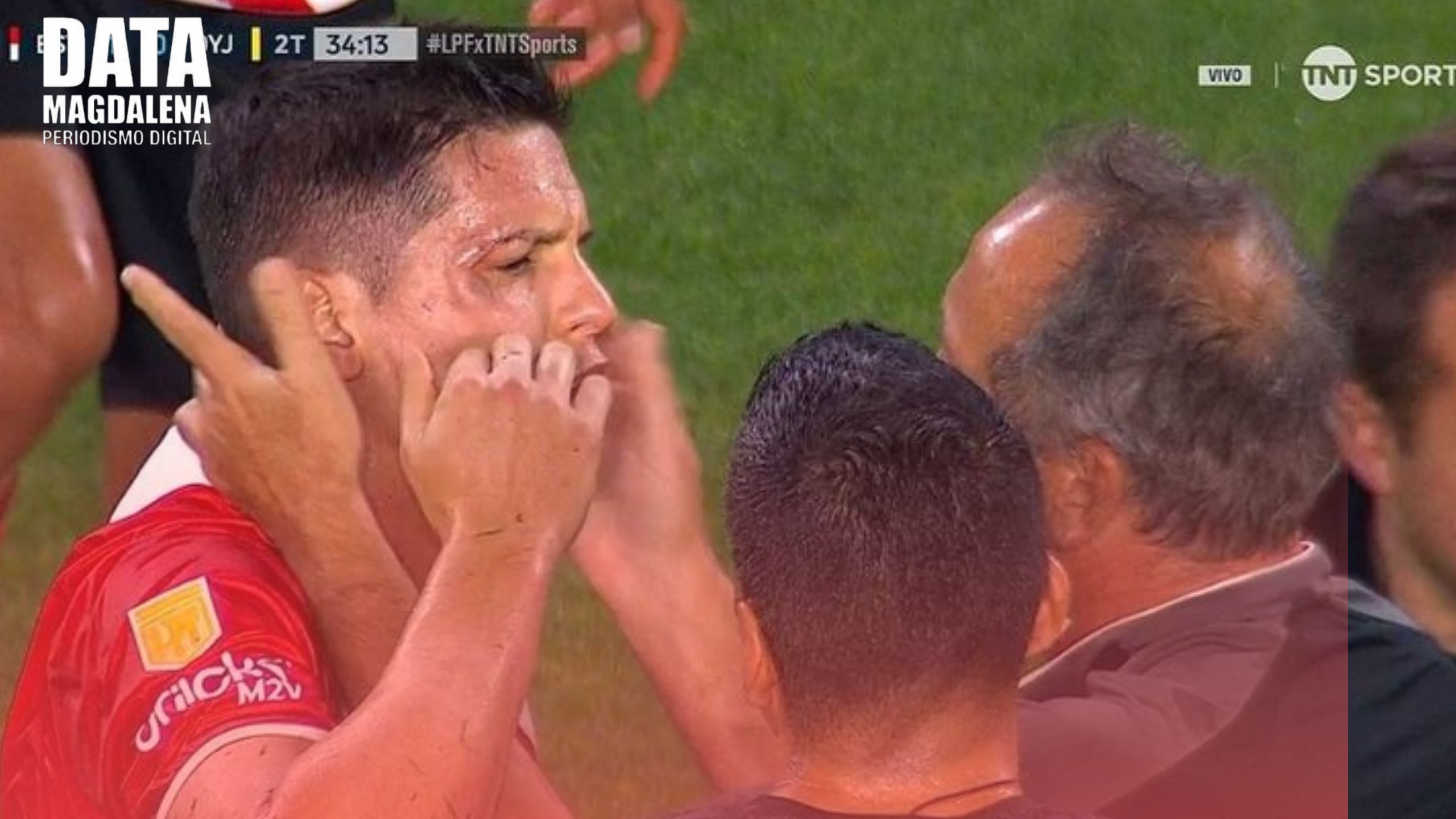 Guido Carrillo sufri&oacute; una fractura en la &oacute;rbita tras fuerte patada y estar&aacute; un mes fuera